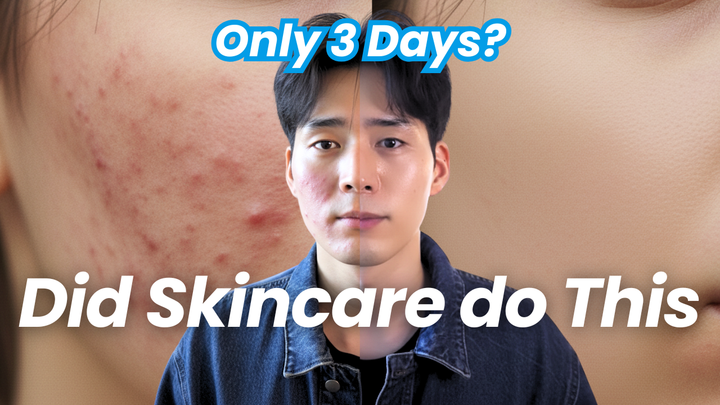 Why Does Skincare from Social Media Always Feel Like It Doesn’t Work?