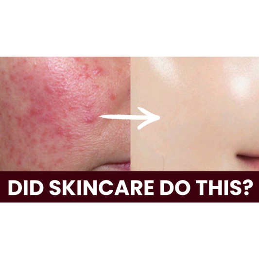 (e-book) 101 Skincare Habits That Are Secretly Sabotaging Your Skin