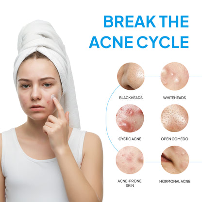 K-Pharmacy Viral Bestseller Bundle for Acne (Ecrin Gel 20g + Acnon Cream 13g + Noscarna Gel 10g)